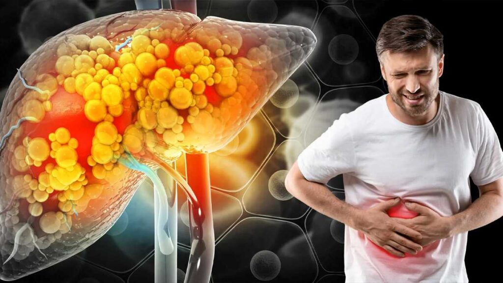 2050-ഓടെ ലോകത്താകെ 180 കോടി ആളുകൾ ഫാറ്റി ലിവർ ഉൾപ്പെടെയുള്ള രോഗങ്ങളുടെ പിടിയിലാകുമെന്നാണ് മുന്നറിയിപ്പ്.