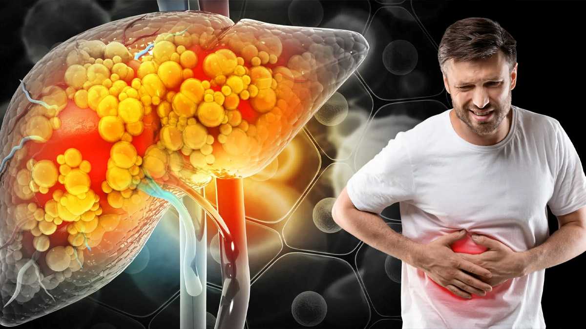 2050-ഓടെ ലോകത്താകെ 180 കോടി ആളുകൾ ഫാറ്റി ലിവർ ഉൾപ്പെടെയുള്ള രോഗങ്ങളുടെ പിടിയിലാകുമെന്നാണ് മുന്നറിയിപ്പ്.